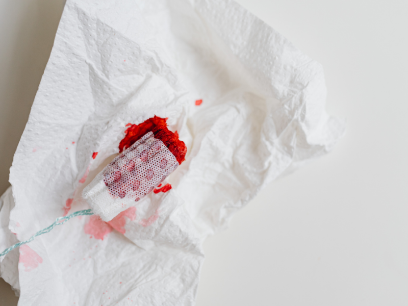 Düzensiz Vajinal Kanamalar